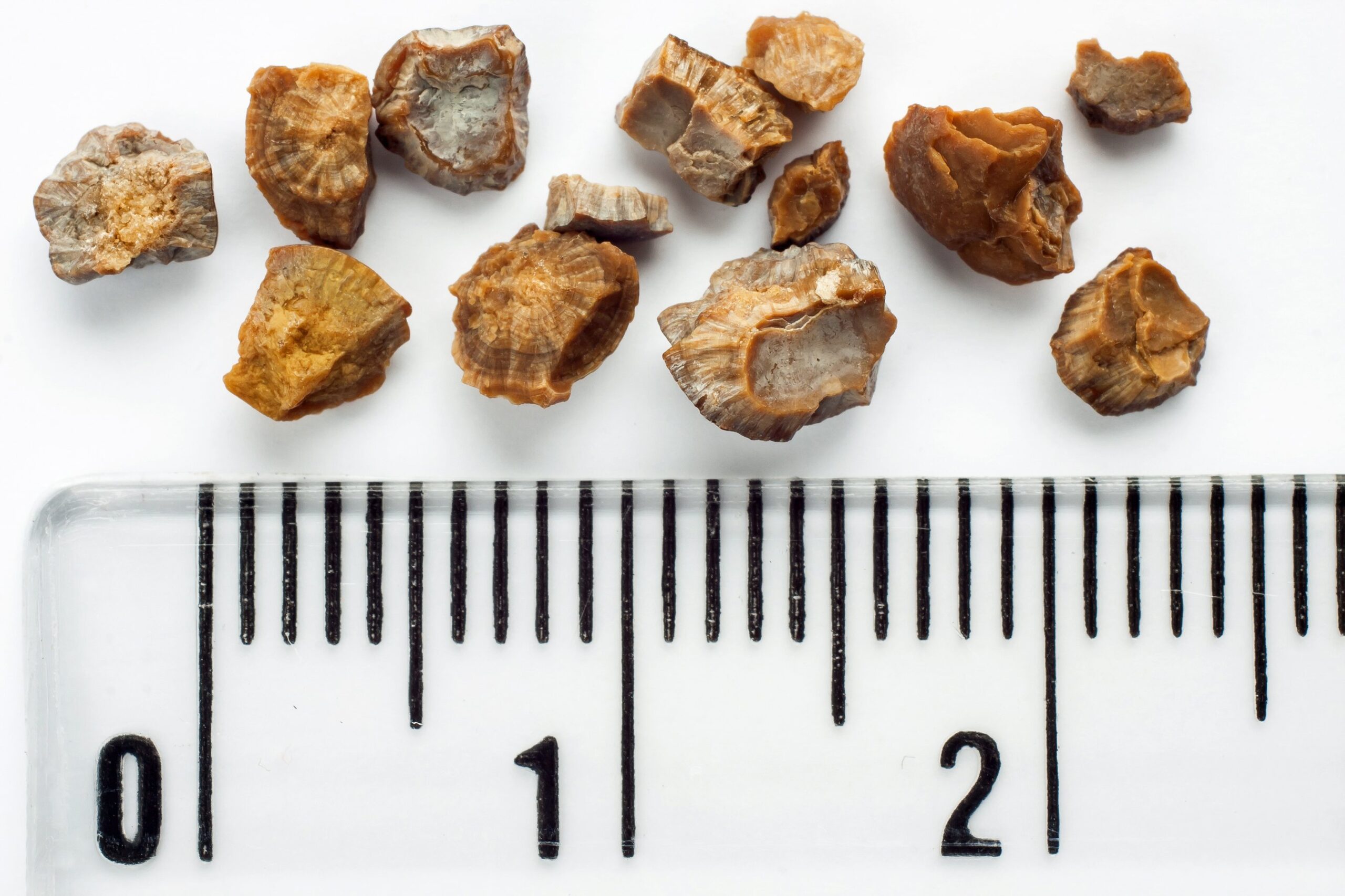 stones